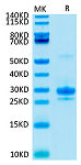 Biotinylated Recombinant Human VEGF-A/VEGF165 Protein (RP02097)