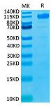 Biotinylated Recombinant Human FLT-1/VEGFR-1 Protein (RP02100)
