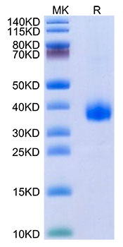 Recombinant SARS-CoV-2 Spike RBD(B.1.640.2/IHU) Protein