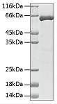 Recombinant Human HSP70 Protein (RP02123)