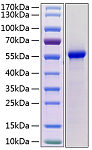 Recombinant Mouse Renin/REN1 Protein (RP02135)