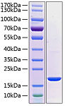 Recombinant Human PRL-2 Protein (RP02140)