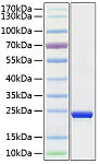 Recombinant Human TMPO Protein (RP02141)