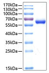 Recombinant Human DLL1 Protein (RP02151)
