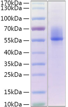 Recombinant Human Decorin/PG-S2/DCN Protein