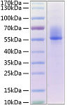 Recombinant Human Decorin/PG-S2/DCN Protein (RP02157)