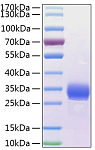 Recombinant Human Angiopoietin-like 4/ANGPTL4 Protein (RP02179)