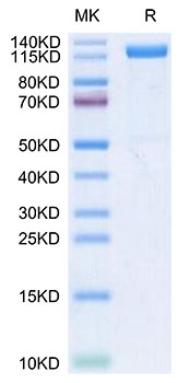 Recombinant Human Klotho beta/KLB Protein