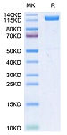 Recombinant Human Klotho beta/KLB Protein (RP02210)