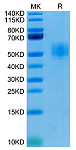 Recombinant Human GFRAL Protein (RP02211)