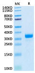 Biotinylated Recombinant Human Angiopoietin-2/ANGPT2 Protein (RP02274)