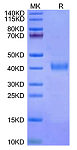 Recombinant Cynomolgus IL-2RB/CD122 Protein (RP02292)