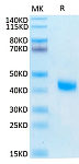 Recombinant Human IL-2RB/CD122 Protein (RP02293)