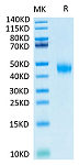 Biotinylated Recombinant Human IL-2RB/CD122 Protein (RP02294)