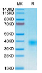 Recombinant Human KP43/CD94 Protein (RP02317)