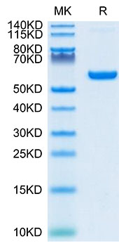Recombinant SARS-COV-2 Spike RBD Protein