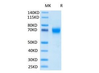 Recombinant Human CSF2RA/GMCSFR-alpha/CD116 Protein