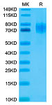 Recombinant Human EGFRvIII Protein (RP02344)