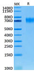 Biotinylated Recombinant Human EGFRvIII Protein (RP02345)