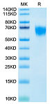 Biotinylated Recombinant Human FGFR-4/CD334 Protein (RP02357)