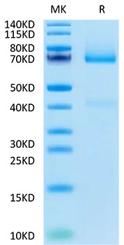 Biotinylated Recombinant Human Glypican-3/GPC3 Protein