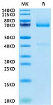 Biotinylated Recombinant Human Glypican-3/GPC3 Protein (RP02371)