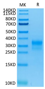 Recombinant Human ErbB-2/HER2/CD340 (Domain IV) Protein