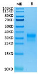 Recombinant Human ErbB-2/HER2/CD340 (Domain IV) Protein (RP02377)