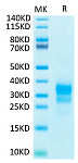 Biotinylated Recombinant Human IFN-gamma Protein (RP02383)