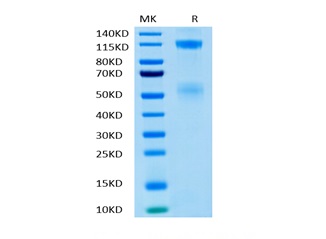 Recombinant Human IGF1R/CD221 Protein