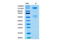 Recombinant Human IGF1R/CD221 Protein (RP02385)