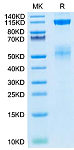 Biotinylated Recombinant Human IGF1R/CD221 Protein (RP02386)