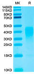 Biotinylated Recombinant Human IL-13 Protein (RP02394)