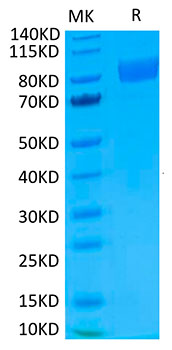 Biotinylated Recombinant Human IL-17RA/CD217 Protein