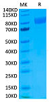 Biotinylated Recombinant Human IL-17RA/CD217 Protein (RP02396)