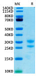 Recombinant Cynomolgus IL-17A/CTLA-8 Protein (RP02409)