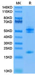 Recombinant Mouse&Human IL-12B&IL-23A Protein (RP02413)