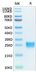 Biotinylated Recombinant Human IL-17F Protein (RP02417)