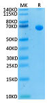 Recombinant Human IL-13RA2/CD213a2 Protein (RP02420)