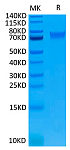 Biotinylated Recombinant Human IL-6RA/CD126 Protein (RP02425)