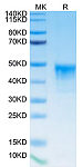 Biotinylated Recombinant Human Mesothelin/MSLN Protein (RP02448)