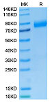 Recombinant Human NKG2-2A/CD159a&CD94 Protein (RP02451)