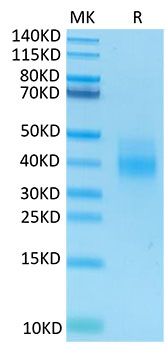 Recombinant Human NKG2A&KLRD1/CD159a&CD94 Protein