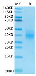 Recombinant Human NKG2-2A/CD159a&CD94 Protein (RP02452)