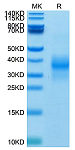 Biotinylated Recombinant Human NKG-2D/KLRK1/CD314 Protein (RP02456)