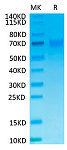 Recombinant Human NCR1/NKp46/CD335  Protein (RP02457)
