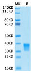 Biotinylated Recombinant Human Oncostatin-M/OSM Protein (RP02464)