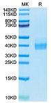 Biotinylated Recombinant Human B7-H1/PD-L1/CD274 Protein (RP02473)