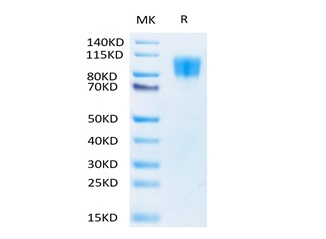 Biotinylated Recombinant Human PDGFR-beta/CD140b Protein