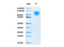 Biotinylated Recombinant Human PDGFR-beta/CD140b Protein (RP02478)